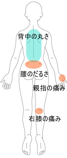 坐骨神経痛 身体の右側が痛い 寝るとき真上に寝れない 西宮で腰痛 手術寸前も可 ならダントツ地域no 1整体院